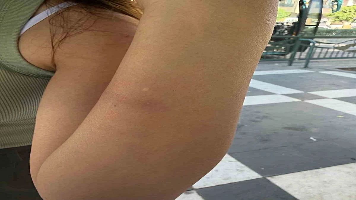 Şanlıurfa’da Otobüste Yaşlı Adama Tekme Atan Şahıs, 3 Kadın Muhabiri Darp Etti