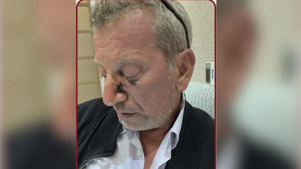 Şanlıurfa’da Veteriner Hekime Boynuz Darbesi: Burnu Kırıldı
