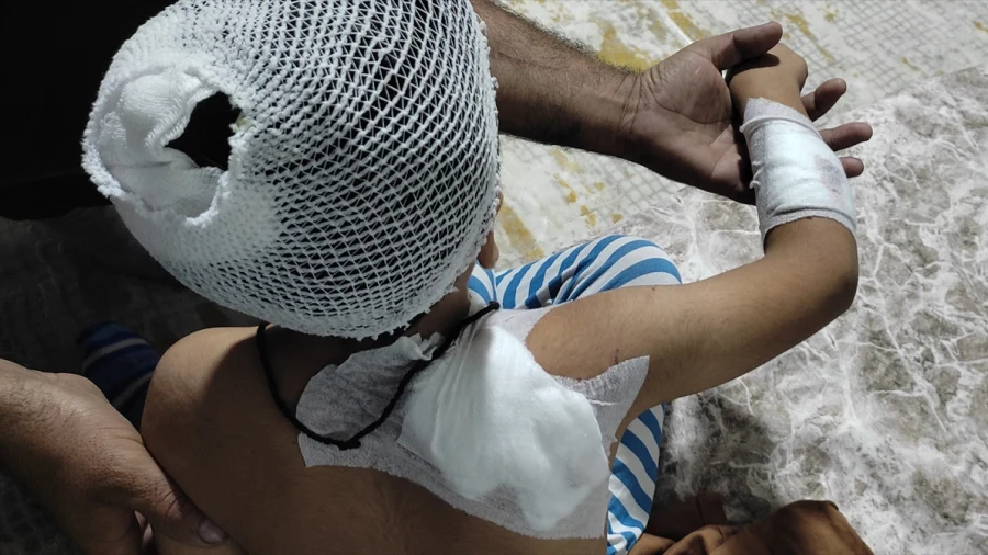 Viranşehir’de köpeklerin saldırdığı çocuk taburcu edildi