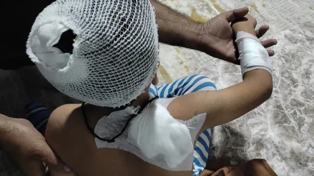 Viranşehir’de köpeklerin saldırdığı çocuk taburcu edildi